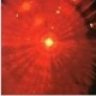 sunfire